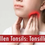 Swollen Tonsils Tonsillitis
